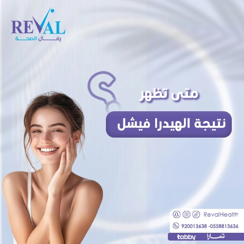تجربتي مع الهيدرافيشل
