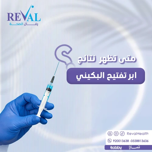 تجربتي مع إبر تفتيح البكيني