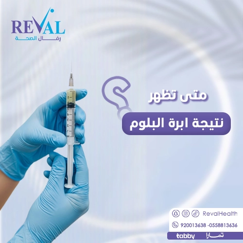 تجربتي مع إبرة بلوم للهالات السوداء