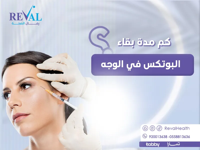 كم مدة بقاء البوتكس في الوجه؟ كيف أحافظ على البوتكس مدة أطول؟
