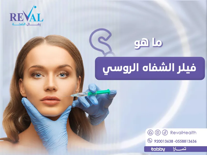 ما هو فيلر الشفاه الروسي👄 كم تدوم نتائج حقن الفيلر الروسي للشفتين؟