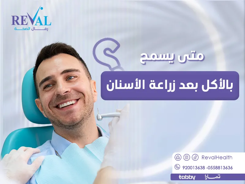 متى يسمح بالأكل بعد زراعة الأسنان؟