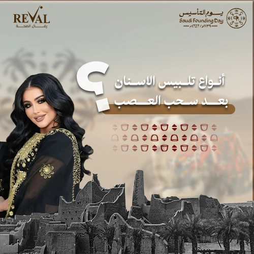 كم تدوم تلبيسة الأسنان بعد سحب العصب؟