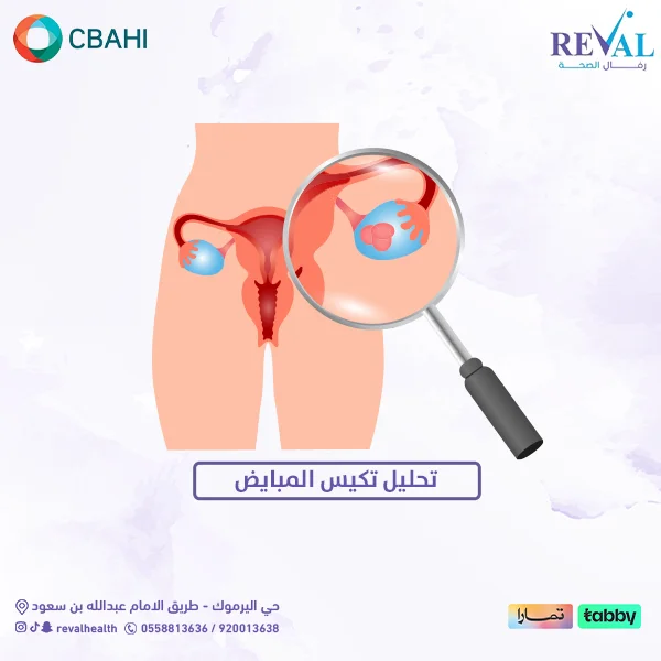 تحاليل تكيس المبايض