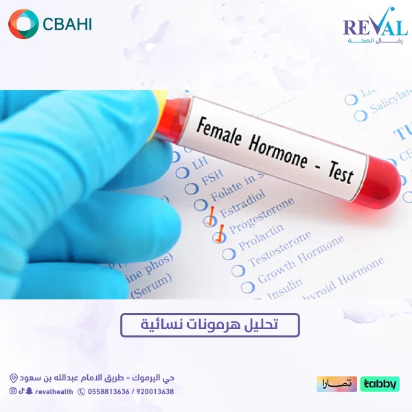 تحليل الهرمونات للنساء