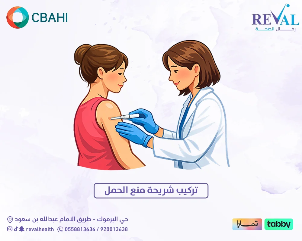 تركيب شريحة منع الحمل
