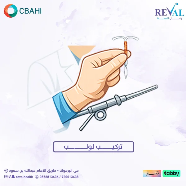 تعليمات قبل وبعد تركيب لولب لضمان أفضل نتيجة وتجنب أي مضاعفات