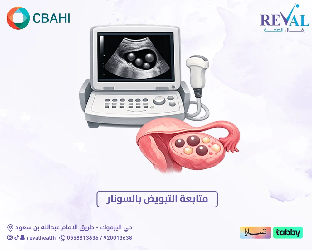 متابعة التبويض بالسونار