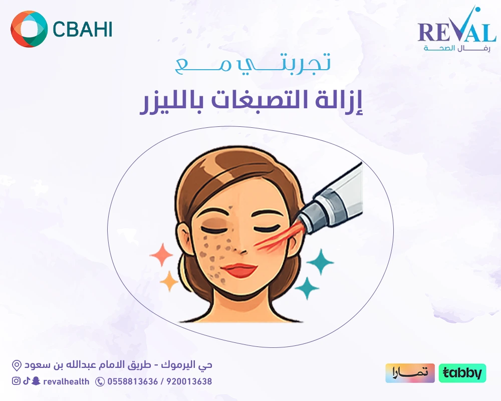 تجربتي مع إزالة التصبغات بالليزر: هل فعلاً تستحق التجربة؟