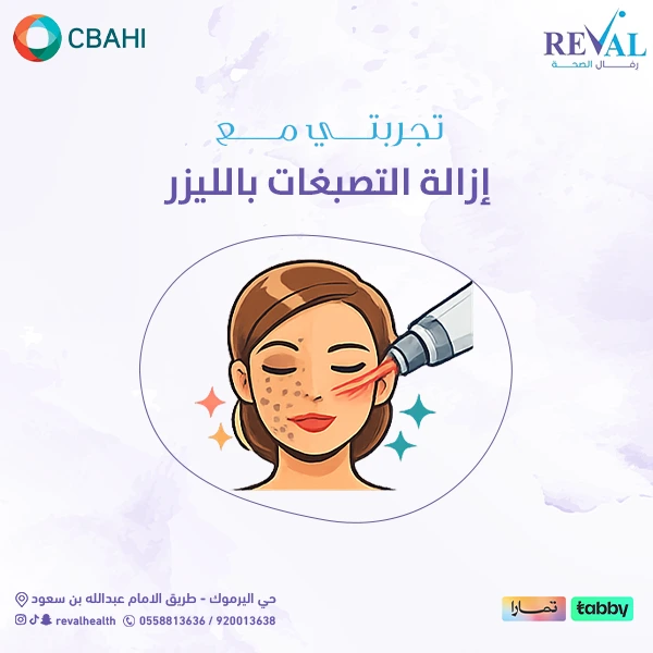 نصائح مهمة قبل إزالة التصبغات بالليزر