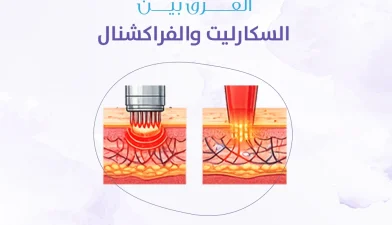 الفرق بين السكارليت والفراكشنال: أيهما أنسب لمشاكل البشرة والندوب وآثار الحبوب؟