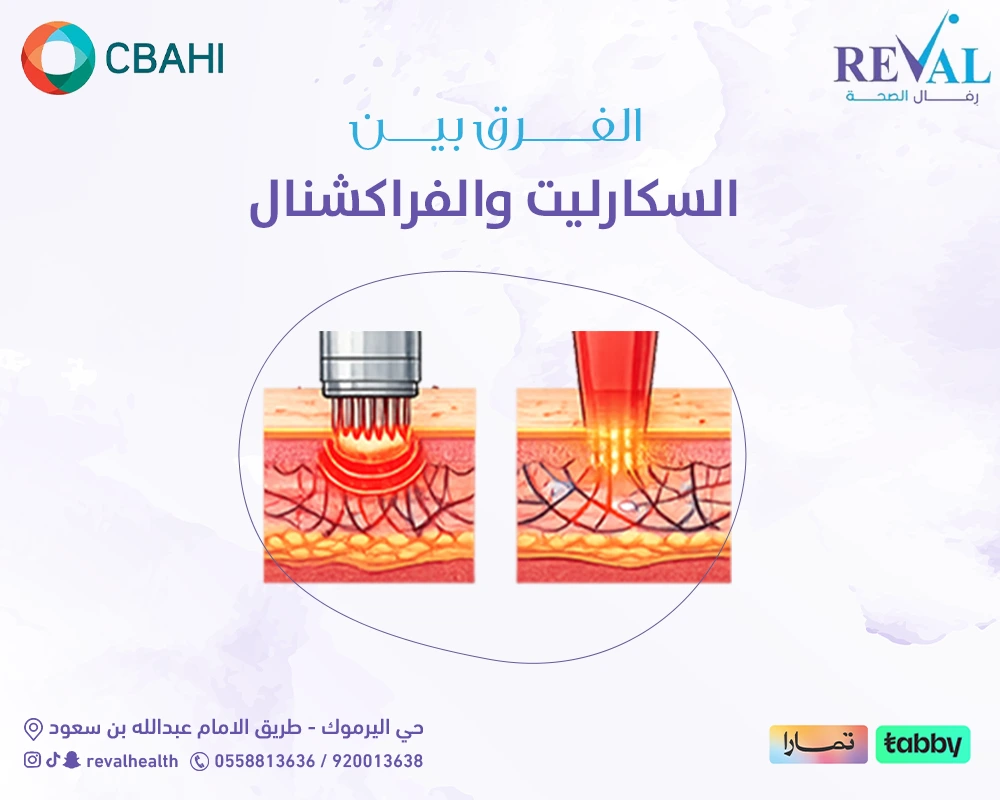 الفرق بين السكارليت والفراكشنال: أيهما أنسب لمشاكل البشرة والندوب وآثار الحبوب؟