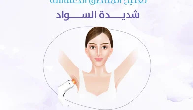 تفتيح المناطق الحساسة شديدة السواد
