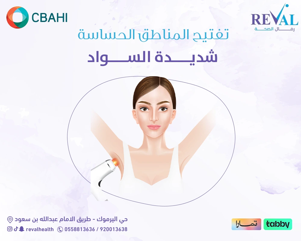 تفتيح المناطق الحساسة شديدة السواد