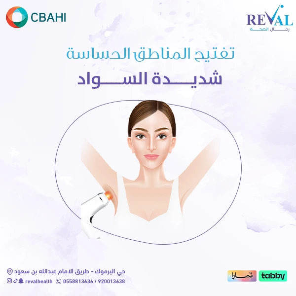 تجربتي مع تفتيح المناطق الحساسة شديدة السواد