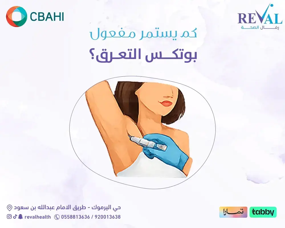 كم يستمر مفعول بوتكس التعرق — وكيف تحجز جلستك في رفال الصحة بالرياض؟
