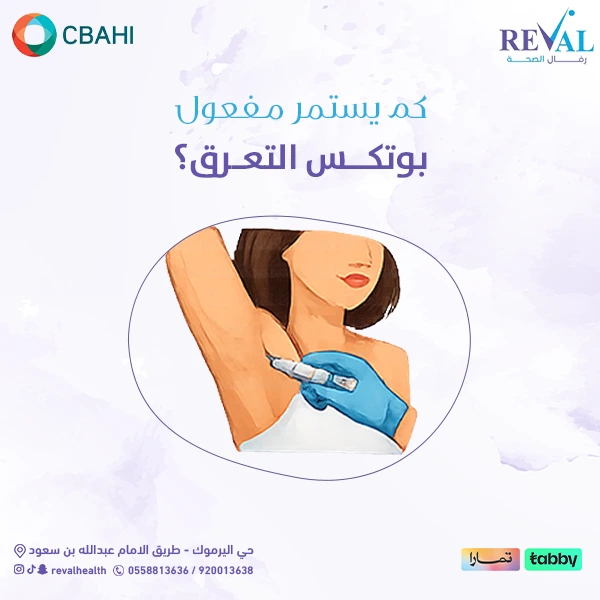 تكلفة جلسات بوتكس التعرق والعوامل المؤثرة فيها