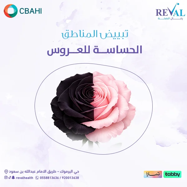 تجربتي مع تبييض المناطق الحساسة 