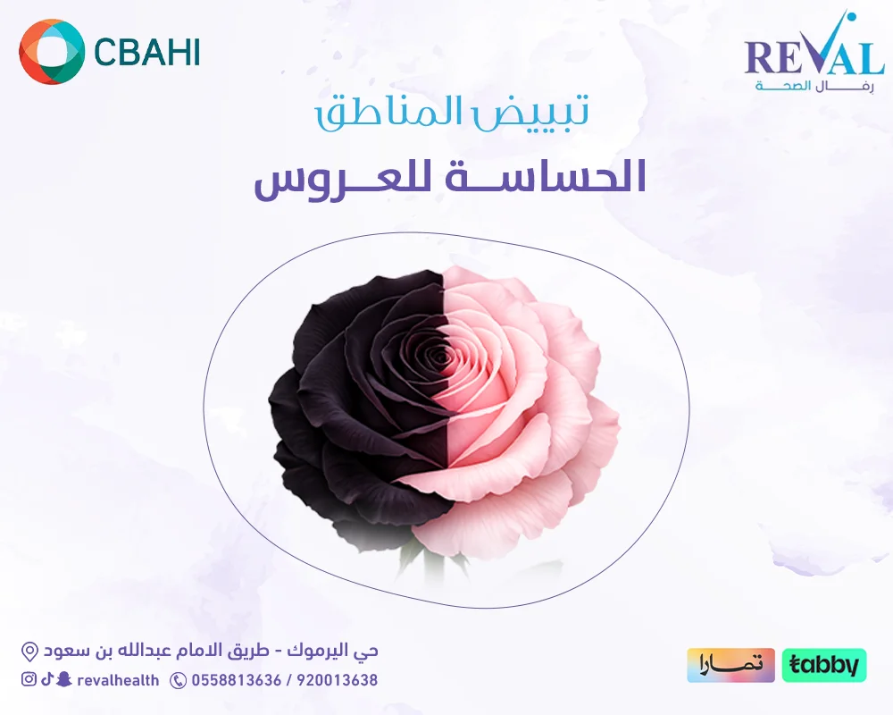تبييض المناطق الحساسة للعروس: الدليل الشامل للنتائج المذهلة قبل الزفاف