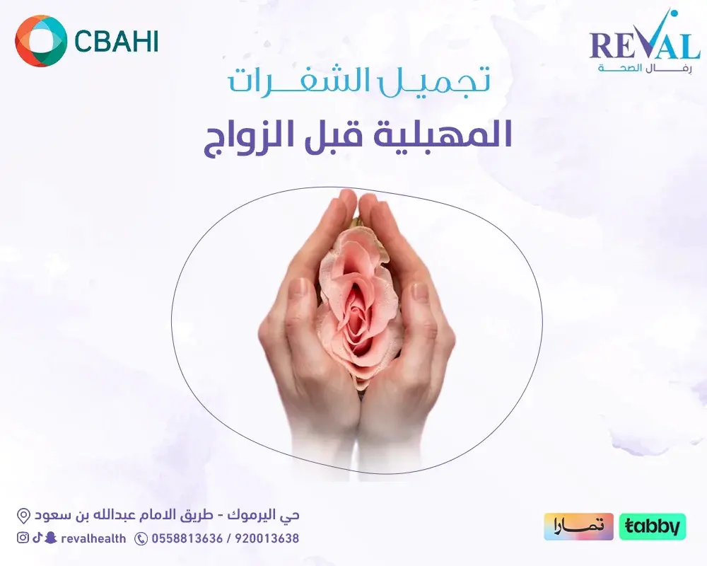 تجميل الشفرات المهبلية قبل الزواج — افضل دكتورة تجميل شفرات المهبل بالرياض