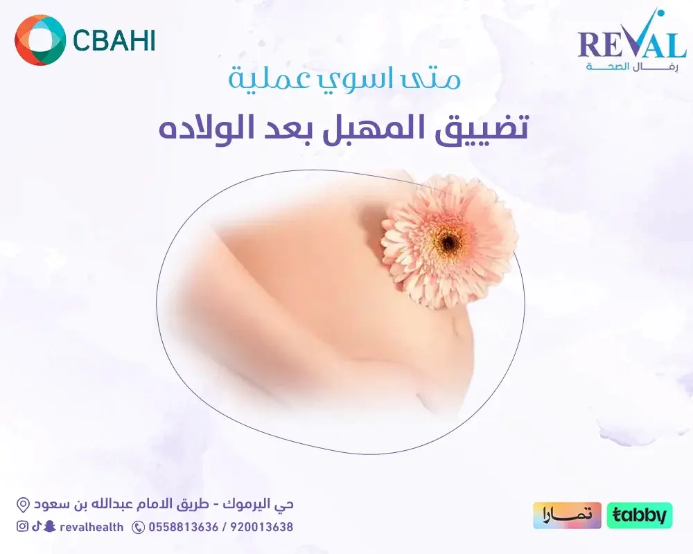 متى أسوي عملية تضييق المهبل بعد الولادة؟ وكيف تختار افضل دكتورة تضييق المهبل بالرياض