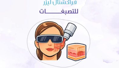 فراكشنال ليزر للتصبغات: الحل الحديث لبشرة صافية بدون تعقيد