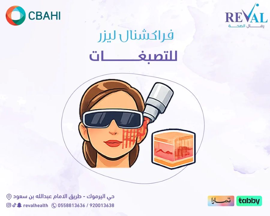 فراكشنال ليزر للتصبغات: الحل الحديث لبشرة صافية بدون تعقيد