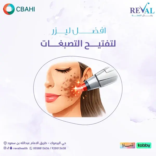 كيف تختارين أفضل عيادة أو طبيب لعلاج التصبغات بالليزر