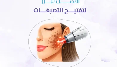 أفضل ليزر لتفتيح التصبغات