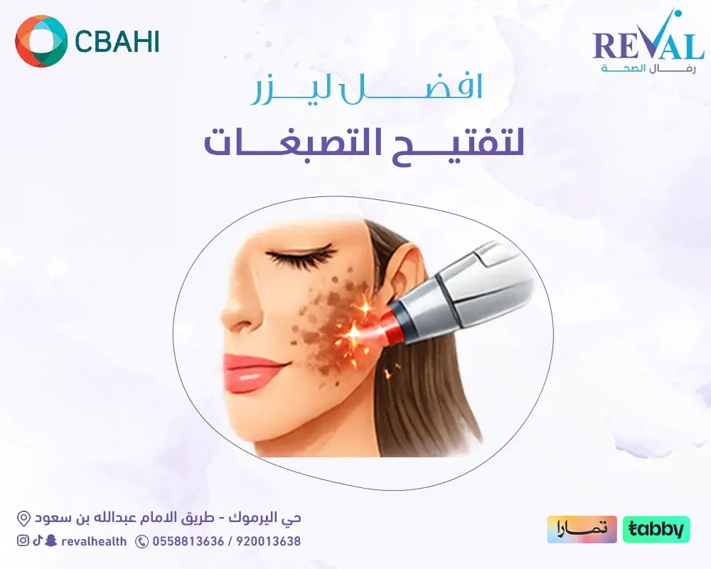 أفضل ليزر لتفتيح التصبغات