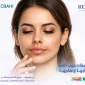 التصبغات حول الفم 85x85