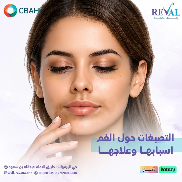تجربتي مع التصبغات حول الفم