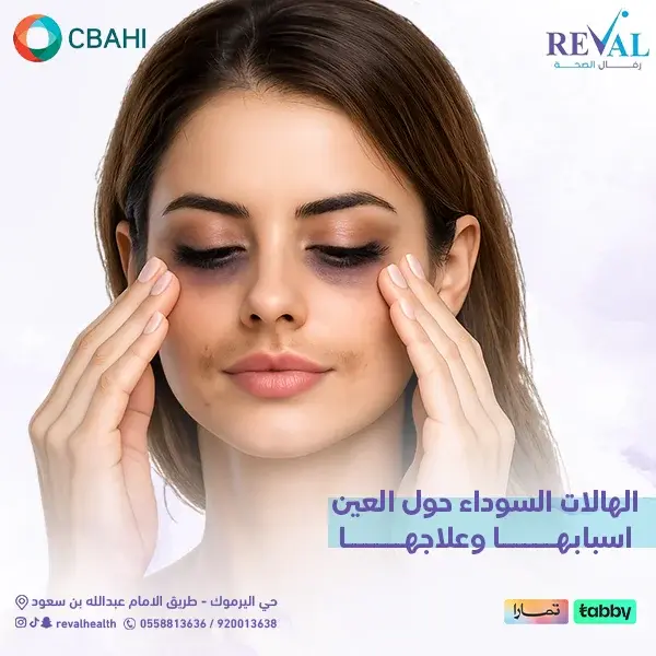 كيفية اختيار أفضل عيادة لعلاج الهالات السوداء؟