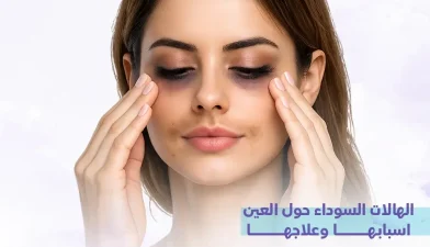 الهالات السوداء حول العين اسبابها وعلاجها: أسرار التخلص منها نهائياً