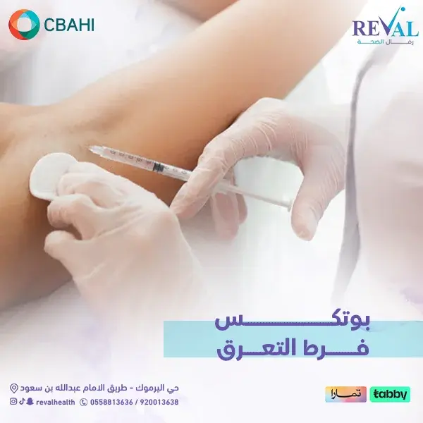 متى تظهر نتائج بوتكس فرط التعرق؟