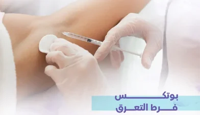 بوتكس فرط التعرق