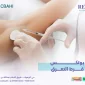بوتكس فرط التعرق2 1 85x85
