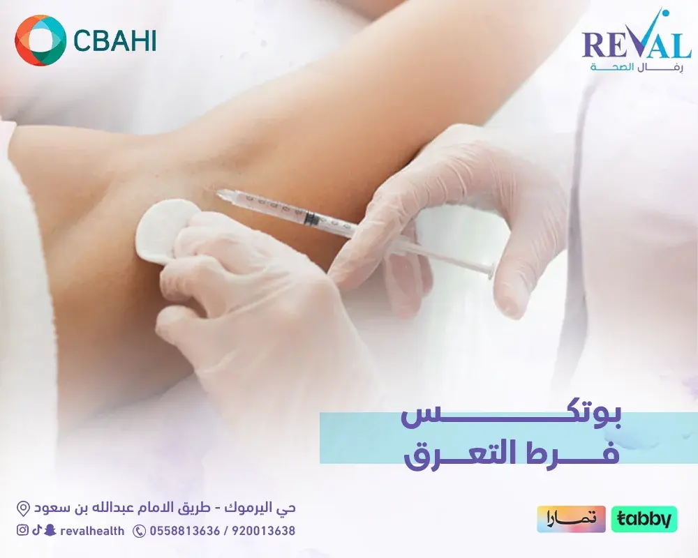 بوتكس فرط التعرق