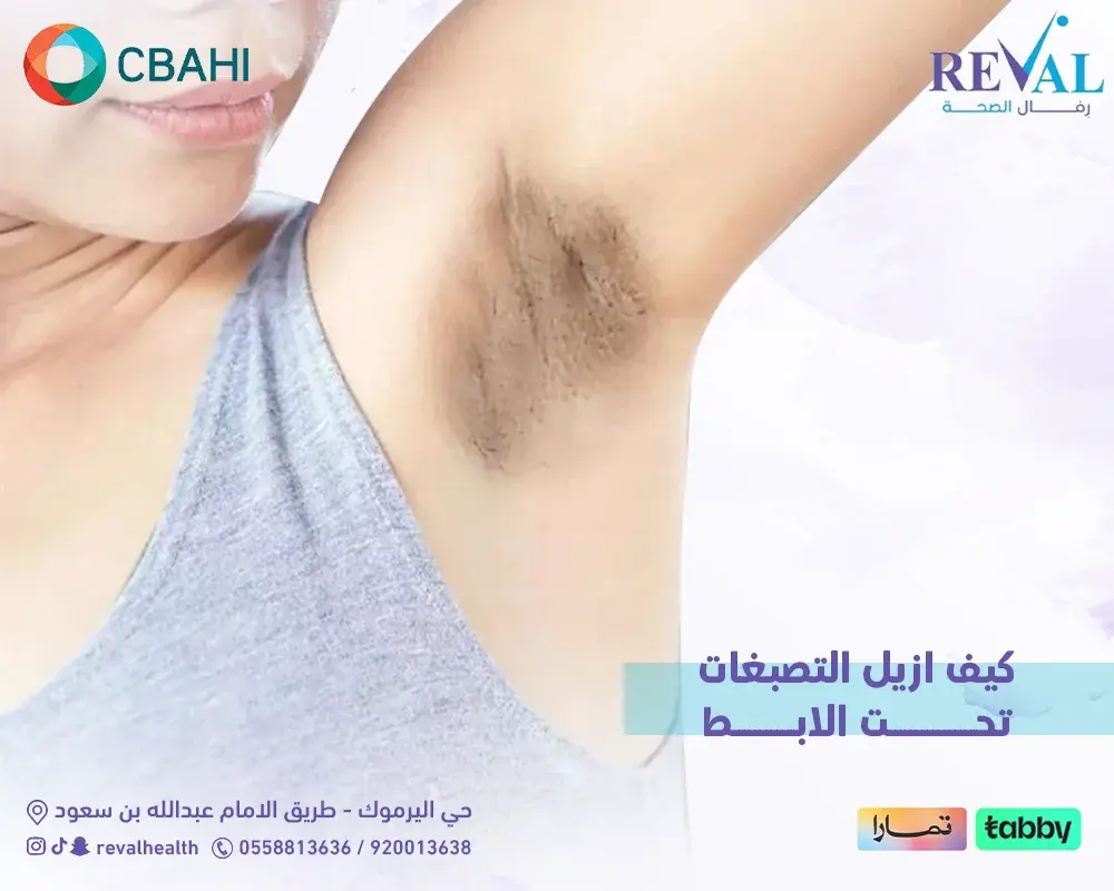 متى تظهر نتائج علاج إزالة التصبغات تحت الإبط؟