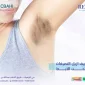 تصبغات الابط 85x85