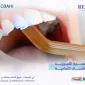 حشوة الكمبوزيت للاسنان الأمامية2 1 85x85