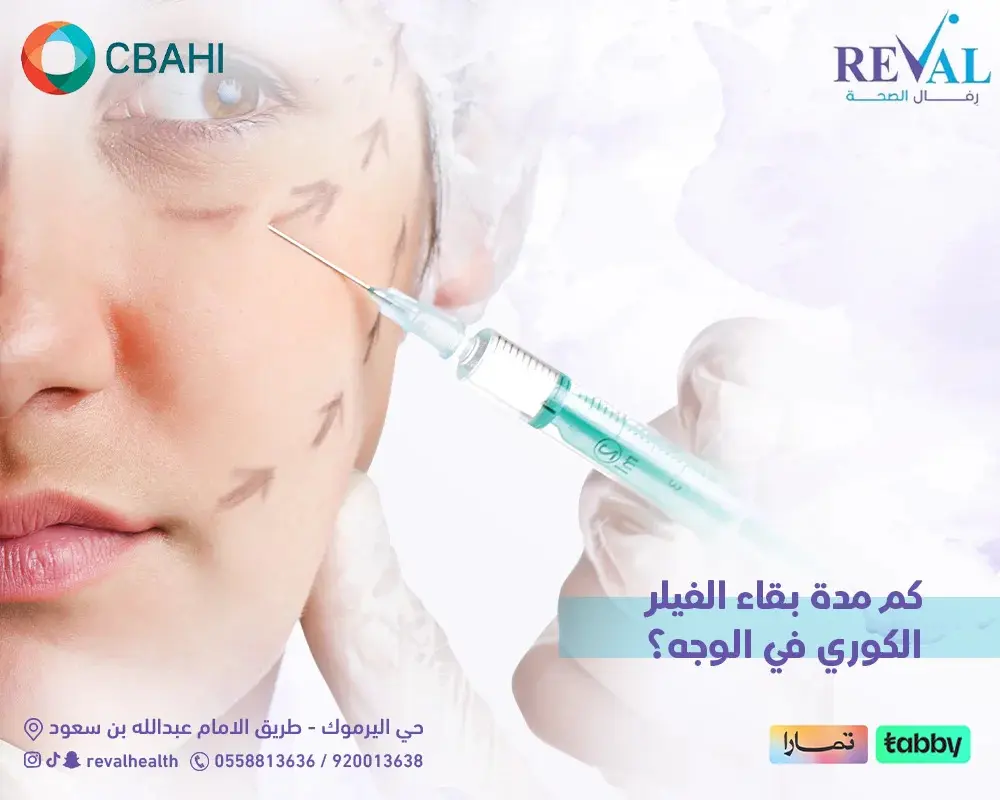 كم مدة بقاء الفيلر الكوري في الوجه؟ العوامل المؤثرة على الفيلر الكوري في الوجه