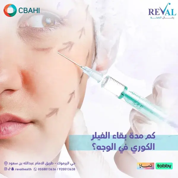 كم مدة الفيلر الكوري للشفايف؟