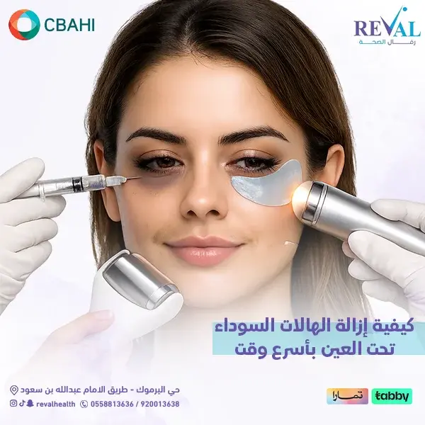 تجربتي مع إزالة الهالات السوداء تحت العين