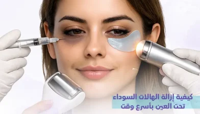 كيفية إزالة الهالات السوداء تحت العين بأسرع وقت: نصائح لتفتيح حول عينيك بنتائج فورية